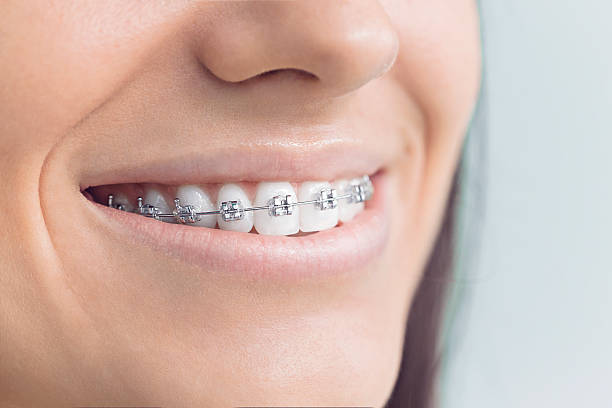 Best Dental Fillings (Composite and Amalgam)  in Decatur, GA